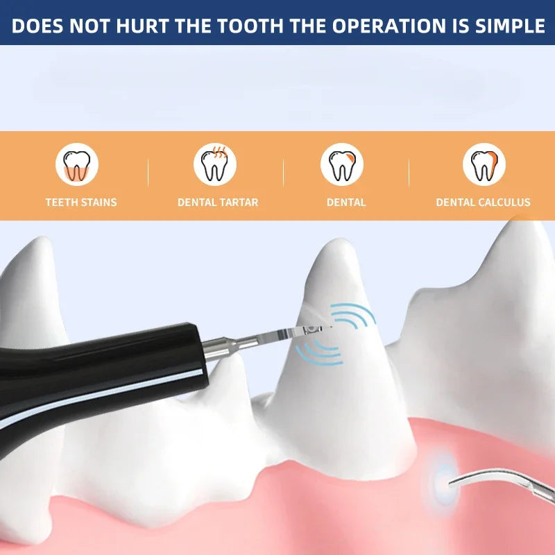 Cat//Dog Electric Ultrasound Teeth Cleaner